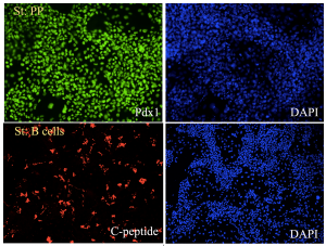 Pancreatic differentiation of human iPSCs in vitro. PPs (top) are stained with Pdx1 antibodies (green) and iBeta cells (bottom) with C-peptide (red). Nuclei are stained with DAPI (blue).